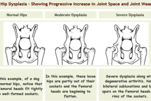La dysplasie des hanches et coudes